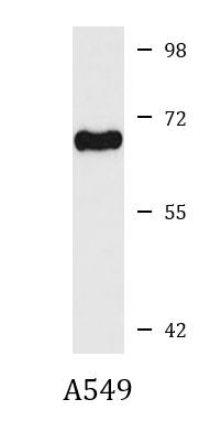 Anti-C4BPA