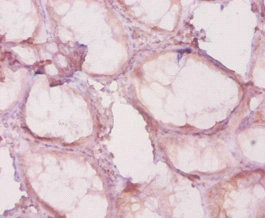 Anti-HDAC4
