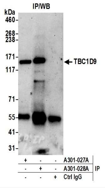 Anti-TBC1D9