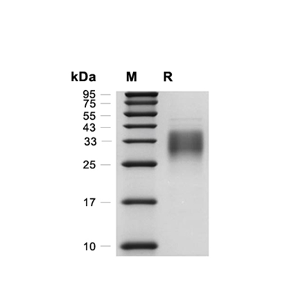 Erythropoietin (EPO) Recombinant (Human)