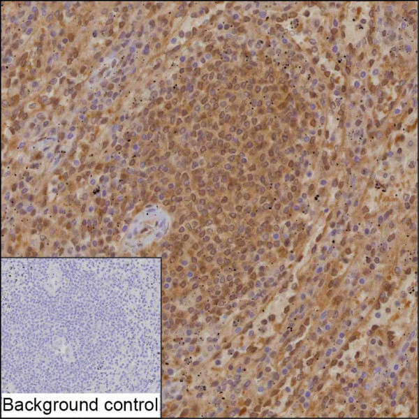 Anti-Proteasome beta 9