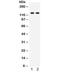 Anti-TLR8