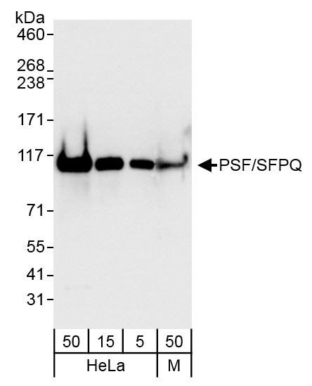 Anti-PSF/SFPQ