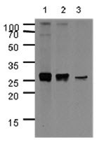 Anti-Apolipoprotein A1, clone 1E12