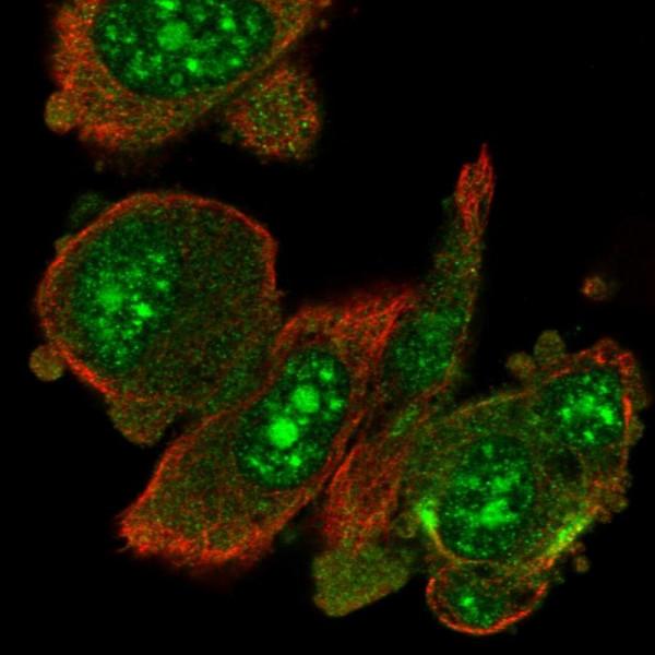 Anti-RIOK1