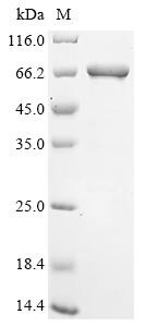 Epstein-Barr nuclear antigen 1 (EBNA1), partial, Biotinylated, Epstein-Barr virus, recombinant