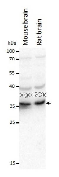 GSDME-mediated Pyroptosis Antibody Panel
