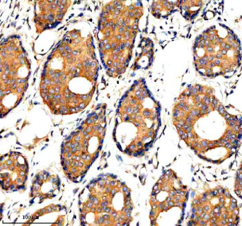 Anti-ADAMTS1 / A disintegrin and metalloproteinase with thrombospondin motifs 1