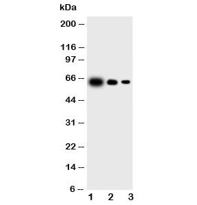 Anti-IL23 p19