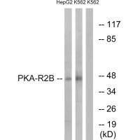 Anti-PRKAR2B (Ab-113)