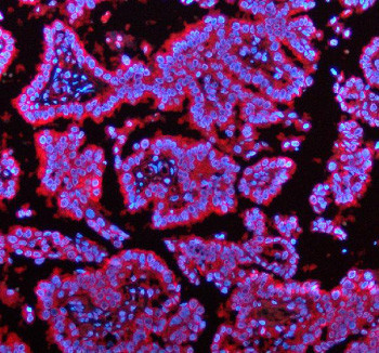 Anti-ENTPD5 / Ectonucleoside triphosphate diphosphohydrolase 5
