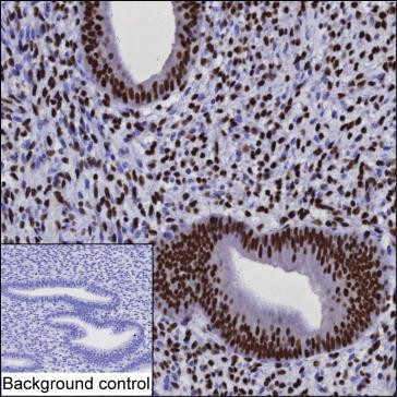 Anti-CHD4