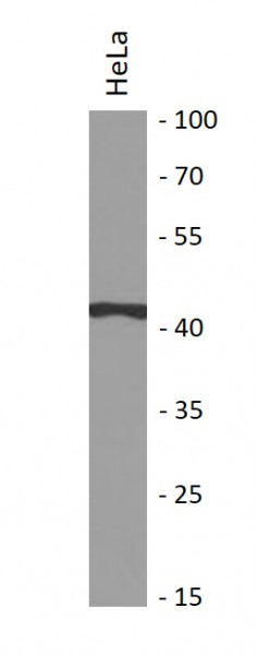 Anti-ITPK1