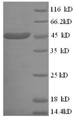 ELAV-like protein 3 (ELAVL3), human, recombinant