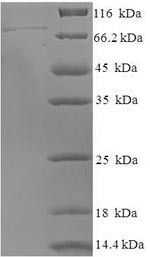 DNA-directed RNA polymerase III subunit RPC3 (POLR3C), human, recombinant