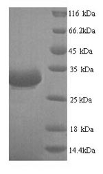 Single-stranded DNA-binding protein gp2.5(2.5), Enterobacteria phage T7, recombinant