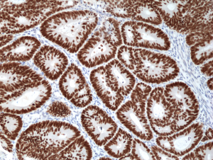 Anti-SATB2 (human), Rabbit Monoclonal (RM365)