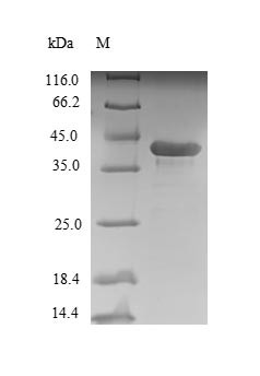 Ribosyldihydronicotinamide dehydrogenase [quinone] (Nqo2), rat, recombinant