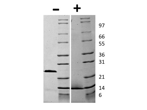 Growth and Differentiation Factor-15 (D variant)