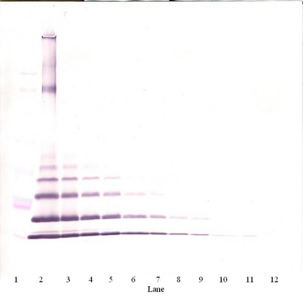 Anti-CCL8 / MCP2