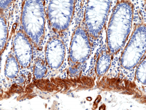 Anti-CALD1 (human), Rabbit Monoclonal (RM396)