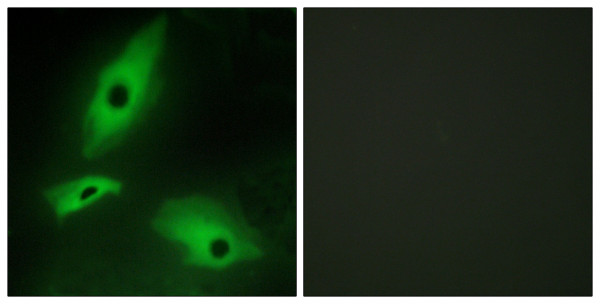 Anti-LTBR / Lymphotoxin beta Receptor