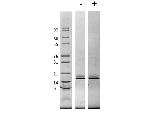 Monocyte Chemotactic Protein-1 (CCL2)