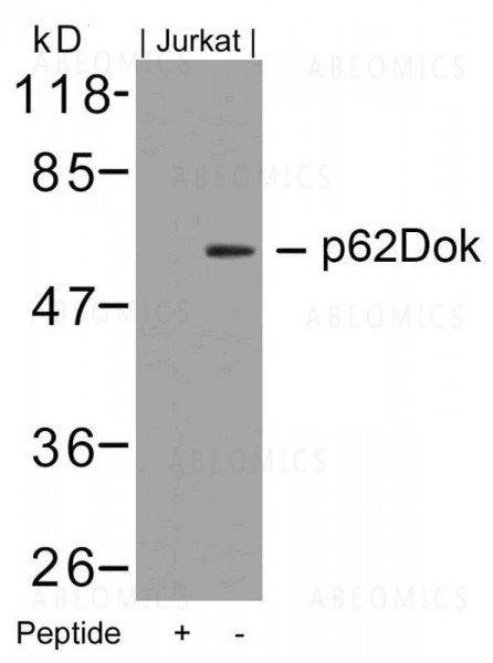 Anti-p62Dok (Ab-362)