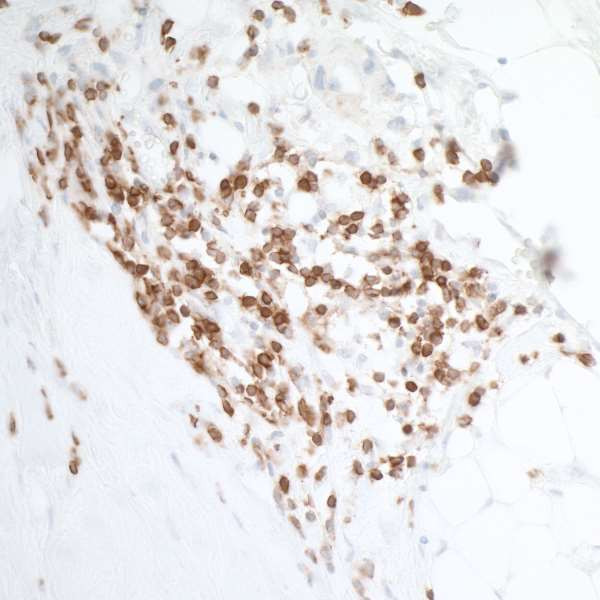 Anti-DNAM-1/CD226 Recombinant Rabbit Monoclonal