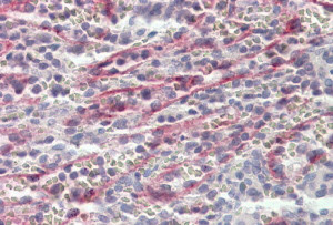 Anti-Stabilin 1, C-terminal