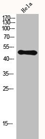 Anti-HDAC3