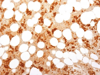 Anti-Transferrin Receptor / TFRC / CD71, clone TFRC/1818