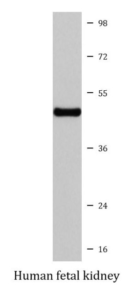 Anti-NPHS2 / Podocin