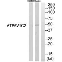 Anti-ATP6V1C2