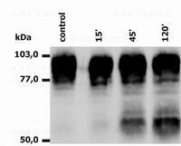 Anti-CD18 / Integrin beta2 subunit Monoclonal Antibody (Clone:MEM-148)
