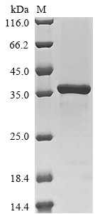 Dolichyl-phosphate-mannose--protein mannosyltransferase 5 (PMT5), partial, Saccharomyces cerevisiae,