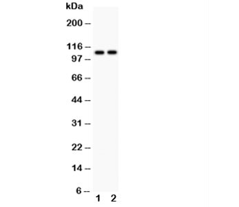 Anti-ATP2A1