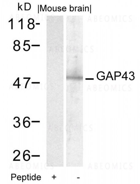 Anti-GAP43 (Ab-41)
