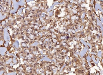 Anti-AHA1 / AHSA1