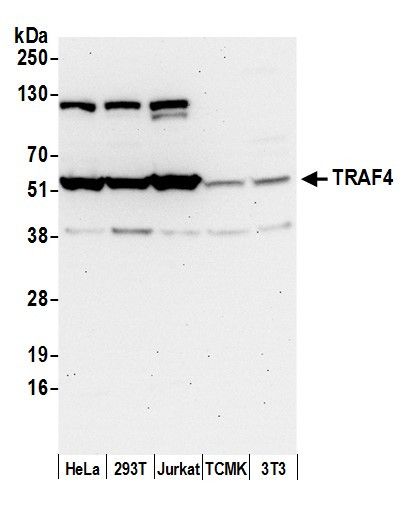 Anti-TRAF4
