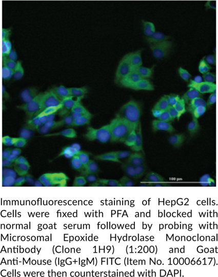Anti-Microsomal Epoxide Hydrolase (Clone 1H9)