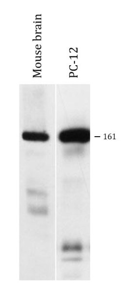 Anti-CLASP1, clone KT66