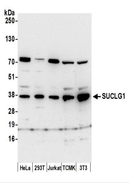 Anti-SUCLG1