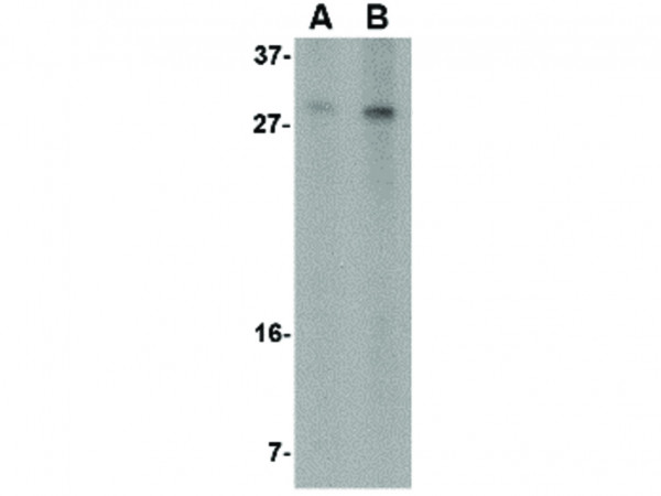 Anti-RTP801