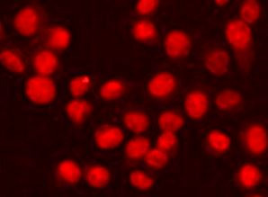 Anti-RPA32 / RPA2, clone 3E7-B5-F2