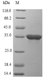 Epstein-Barr nuclear antigen 1 (EBNA1), partial, Epstein-Barr virus, recombinant