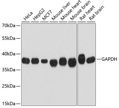 Anti-GAPDH (CABC002)