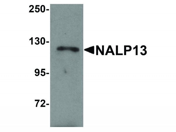 Anti-NALP13
