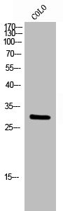 Anti-RAB6A