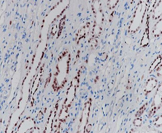 Anti-PAX2, clone SQab1896